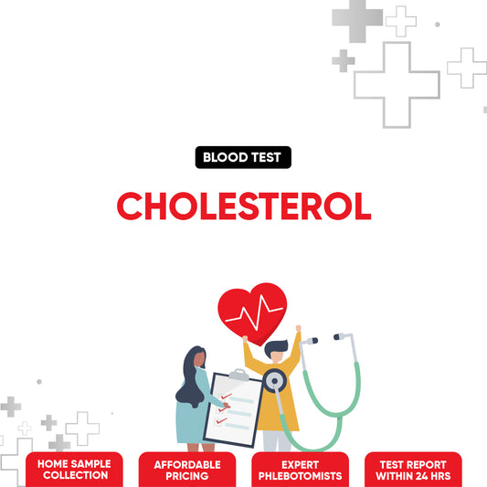 Cholesterol Test