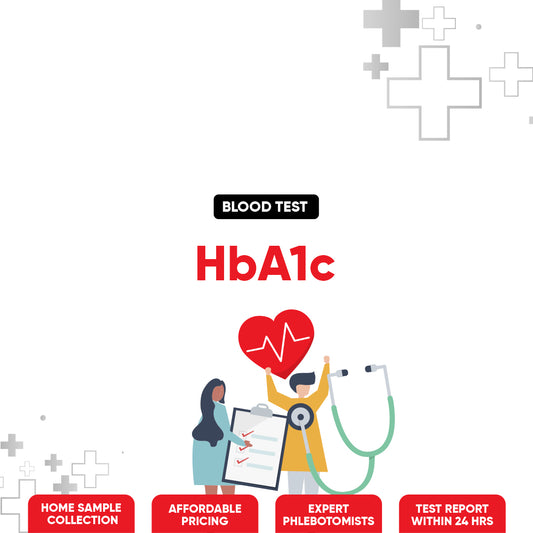 HbA1c Test