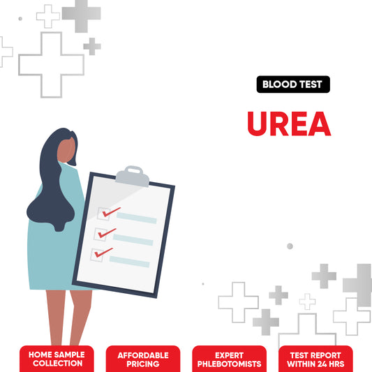 Urea Test