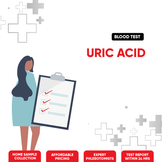 Uric Acid Test